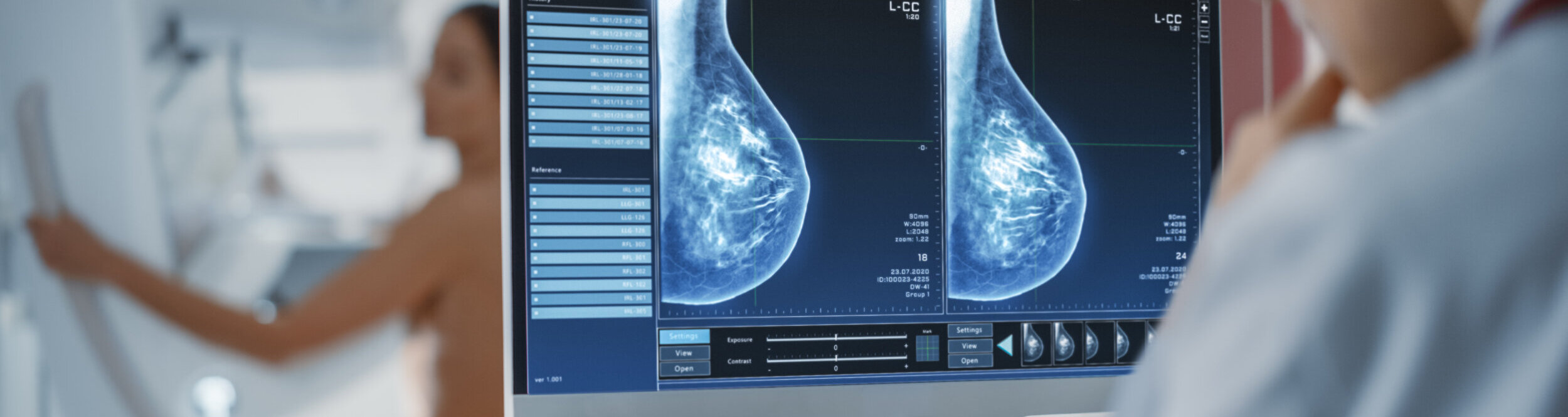 Eine Ärztin analysiert Bilder einer Mammographie. 