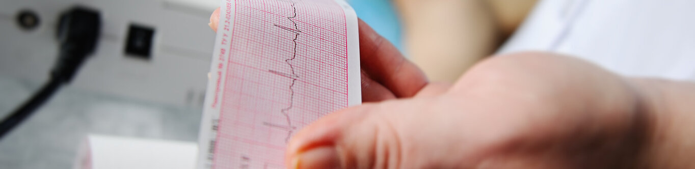 Schwester führt EKG am Patienten durch.